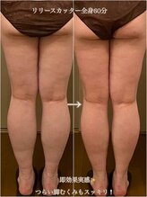 ハナ(HANA)/【脚元のむくみ／冷え】お悩み