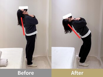 せなかのはね 井尻店/30代　肩こり　猫背　腰痛