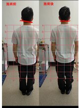 越谷ゆずりは整体院/施術前→施術後