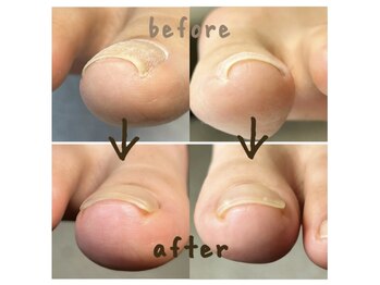 ネイル キュア NAIL CUREの写真/自爪にコンプレックスがある方のケアやフットの巻き爪ケアもお任せ下さい◎