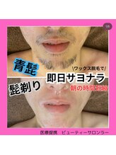 ラー(La)/青髭のストレスから解消