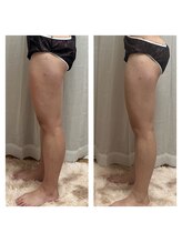 ヨサパーク 鶴見東口店(YOSA PARK)/下半身も１回でこの効果！