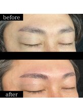 ユー 千葉駅前店(you)/症例写真