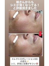 顔凛(カオリン)/肌質改善