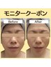 【1ヶ月集中2回来店】小顔コルギフェイシャルモニター！毎月3名お早めに★