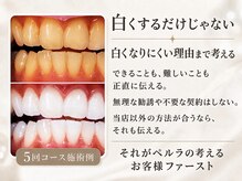 ペルラメディカルホワイトニング 名古屋