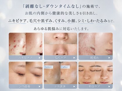 ホワイトアクア 鳳店(WHITE AQUA)の写真