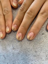 ラングル(L'ongle)/