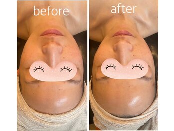 リーズ(Rees)/リフティングコース