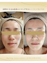 心音/長くなった縦幅が短くなりました