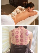 モハラ(Mohala)/カッピング