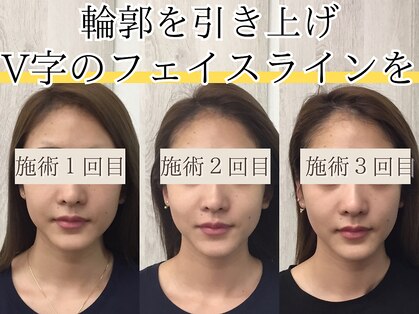 アズイズビューティー 草津店の写真