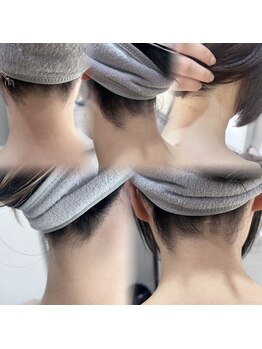 アンシュシュ(UNCHOUCHOU)/うなじ脱毛で垢抜け!