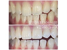 ホワイトニングルーム 横浜店(Whitening Room)/ホワイトニング/横浜