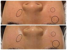 エフェクト 塚口店(effect)/before &nbsp;&nbsp;after