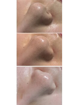 アンドワイ バイ サロンリーナ(&y by Salon Lena)/【徹底的毛穴洗浄×ハーブ】