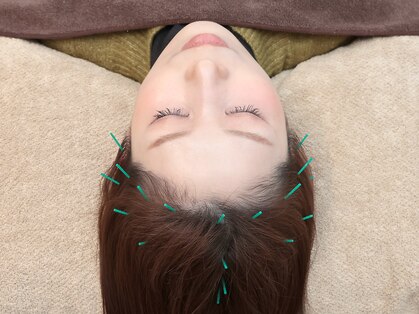 サクランボ(SAKURAMBO)の写真