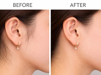 スムース(SMOOTH)/フェイスWAXで横顔までも美しく