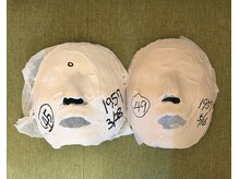 シャインビューティー(ShineBeauty)/石膏パクビフォーアフター写真