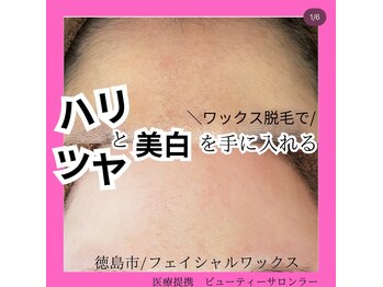 ラー(La)/艶肌美人が手に入るメニュー