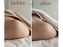 ナチューラ(Natura)/一度の施術で巻き肩改善　その２