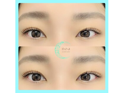 ノア(noa)の写真