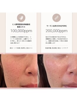 ルミライズ(Lumirise)の写真/他社比較3倍以上！リジュランでおなじみPDRN★美白/毛穴ケア/ニキビケア/ハリ透明感