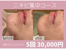 ミルキー(MiLuKy)