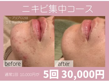 ミルキー(MiLuKy)