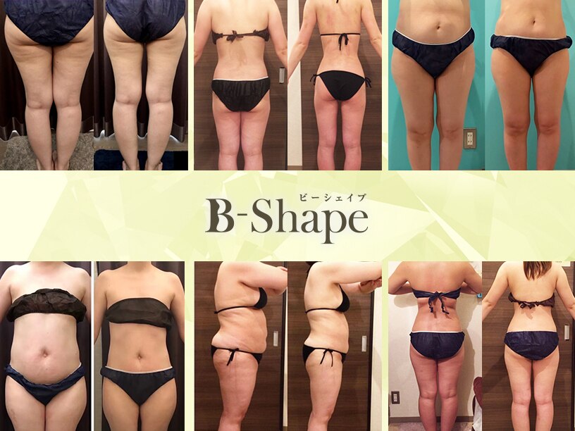 ビーシェイプ 君津(B-Shape)｜ホットペッパービューティー