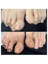 ネイルアトリエ ボン(nail atelier bon)/フットネイルケア