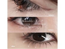 ステイゴールド(STAY GOLD)/下まつげアンドヘルシー