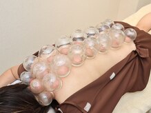 柚香鍼灸院の雰囲気（頑固な肩こり腰痛、冷え、全身疲労にはカッピング！初心者にも◎）