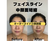 リル(LIL)の雰囲気(BeforeAfter)
