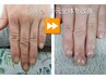 【美爪と手肌の年齢サイン改善ケア】美爪育成+エイジレスハンドエステ 120分