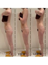 プルメリア(Plumer’a)/楽々☆プロポーション改善