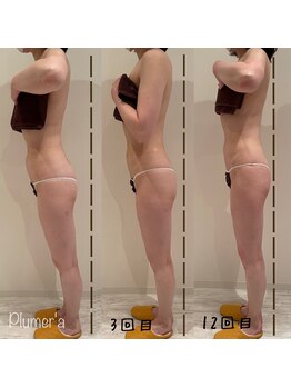 プルメリア(Plumer’a)/楽々☆プロポーション改善