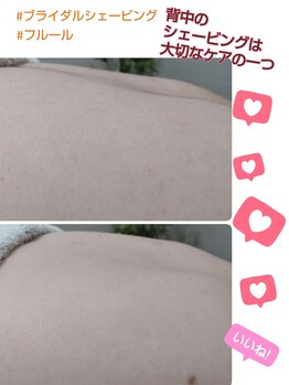 エステシェービングサロン フルール(Fleur)/背中のシェービング