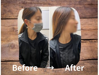 整体院プリュ/Before→ After［11］