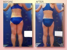 ジュリア オージェ 四条河原町店/ビフォーアフター（脂肪燃焼）