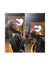 古田整体院/首肩が痛くて上を向けない！