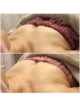 サチ(Sachi)/5２歳でも大丈夫ですか？