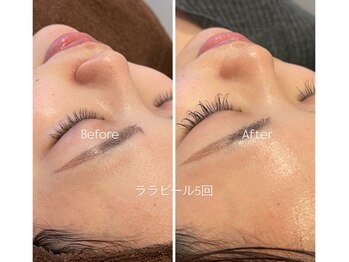 ライフサロン 恵比寿(Life Salon)/話題のララピールも導入!