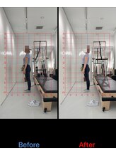 ピラティスエルエー(pilates LA)/たった1回のビフォーアフター