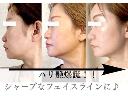 シャインアン(Shine'an)の写真