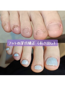 マニエネイル(mani e nail)/足爪の自爪育成始めませんか？