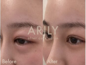 アリリィ(ARILY)/ARILY after care salon