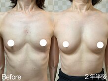 ハレオラ(HaleOla)/50代☆体調を崩しても戻らない