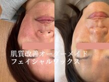 ハナワクシングプラス 高知(HanaWaxing+)の雰囲気（顔脱毛/フェイシャルワックス/ブラジリアンワックス/VIO脱毛）