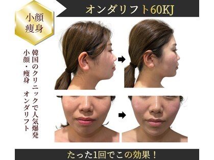 青空 天神大名店(SORA)の写真